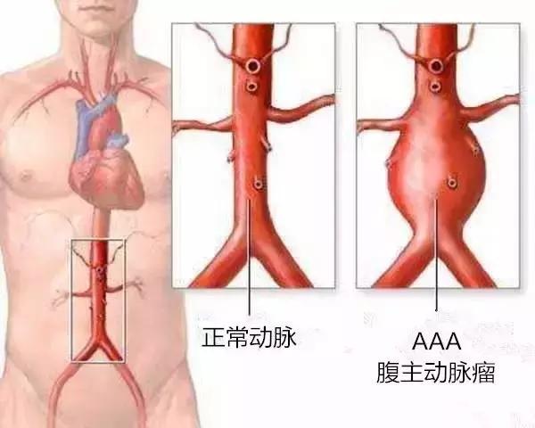 有一种病英文名,有一种病