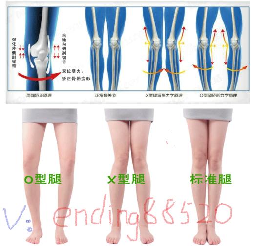 o型腿为什么叫膝内翻,腿弯是骨头原因吗