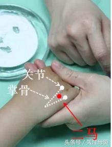 小儿鹅口疮的推拿调理手法