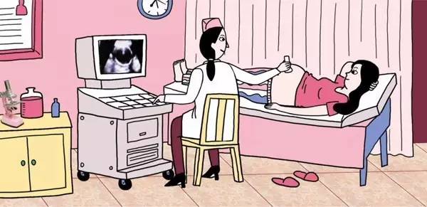 孕妈必备详细清单,孕期35天b超能看出来吗