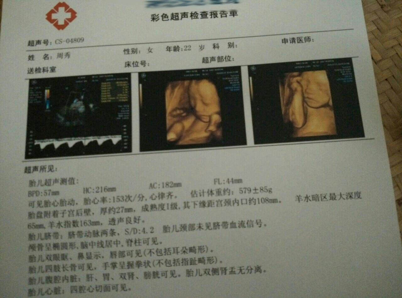 媳妇怀孕了，四维彩超能帮助我们了解什么？