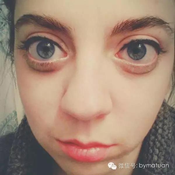 拥有一双大眼双眼皮,拥有好看侧颜单眼皮