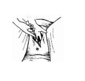 产后侧切缝线是用的什么线,产后妈妈侧切后的护理