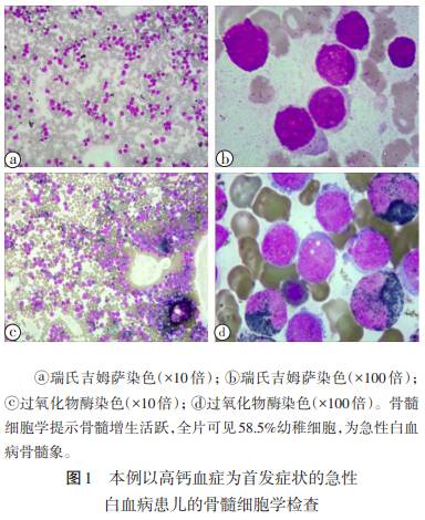 3岁孩子低钙血症的临床表现,儿童高钙血症的症状有哪些