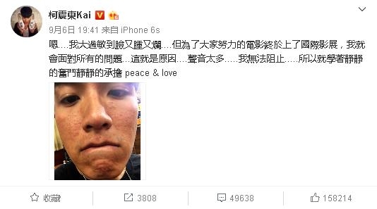 柯震东与房祖名连线,柯震东与房祖名直播连线