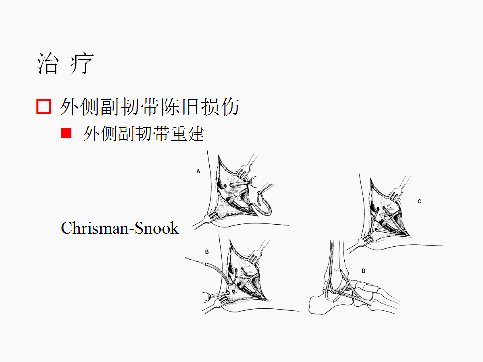 脚崴了怎么办判断是否骨折,脚崴了怎么办视频