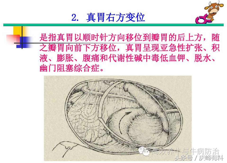 奶牛真胃扩张的症状治疗方法,奶牛皱胃左方变位治疗方法