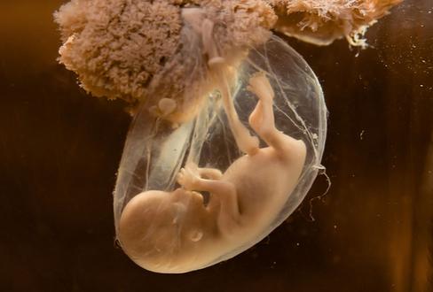 孕妇一天不喝水羊水会变少吗,一天不喝水羊水就少怎么回事