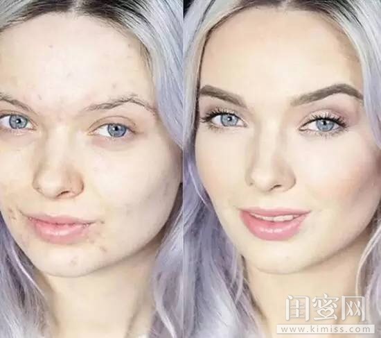 痘印淡化神器推荐第一名,痘印克星