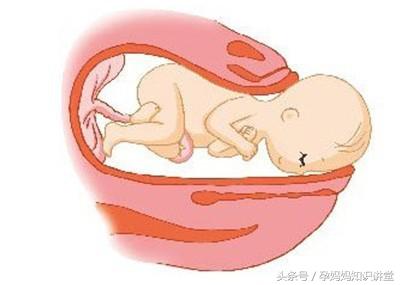 假临产鉴别,假临产怎么判断