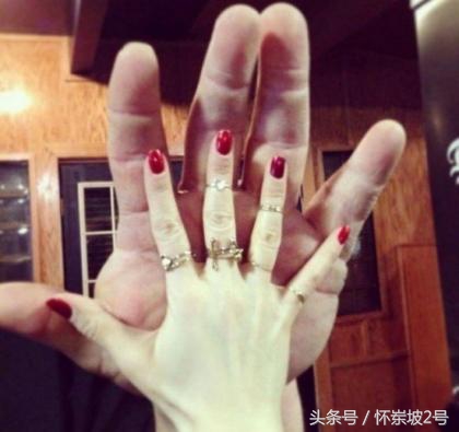 打开这个开关手机再用3年也不卡,打开这个开关