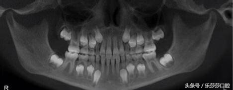 牙医能辨别出换过没换过的牙齿吗,牙医见过最好的牙齿是怎么样的