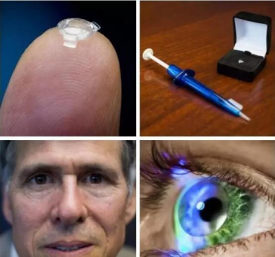 最新科技的高度近视超薄镜片,加拿大近视仿生镜片