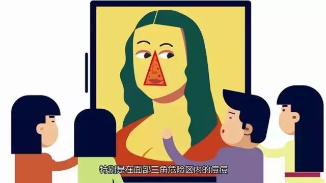 协和治疗黑头粉刺,协和医院皮肤科黑头