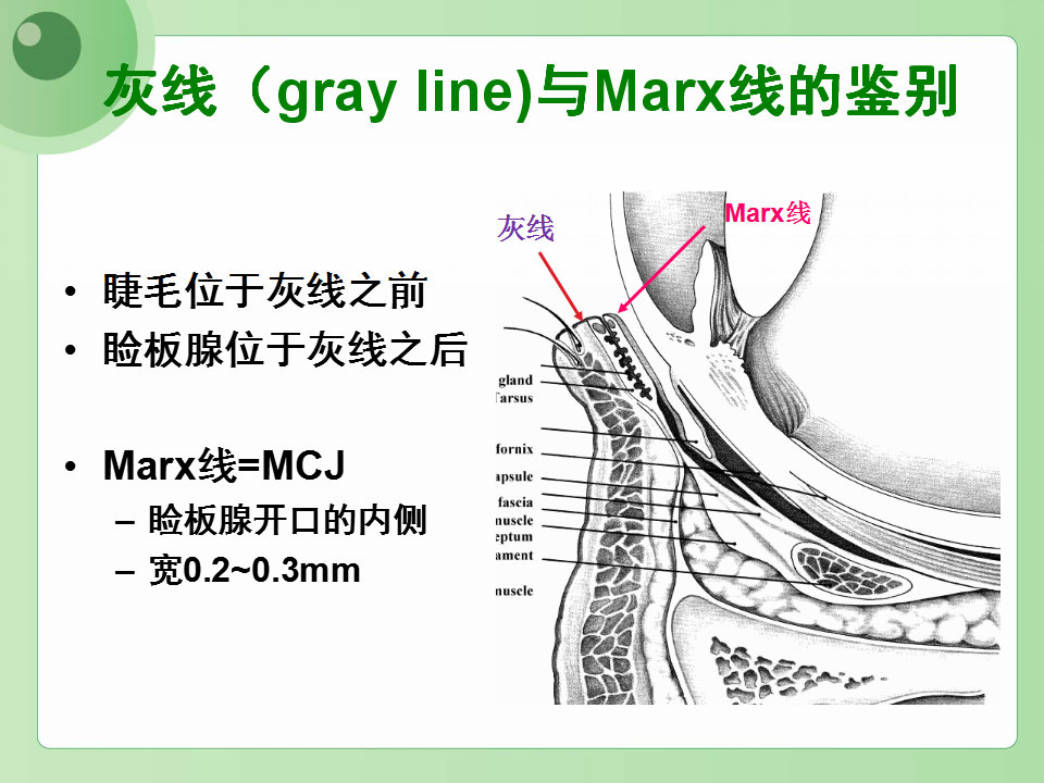 眼睑缘炎的发病原因,眼睑炎的症状和治疗方法