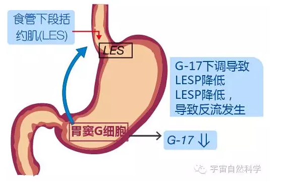 胃泌素17功能检测有必要吗,胃泌素17偏低要做什么检查
