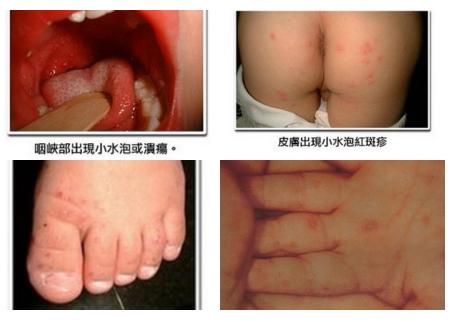 爱宝宝除了亲还有什么表达方式,抱抱和亲亲表达爱意的方式