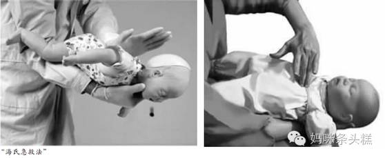幼儿园孩子呛噎急救方法,宝宝呛到气管急救法
