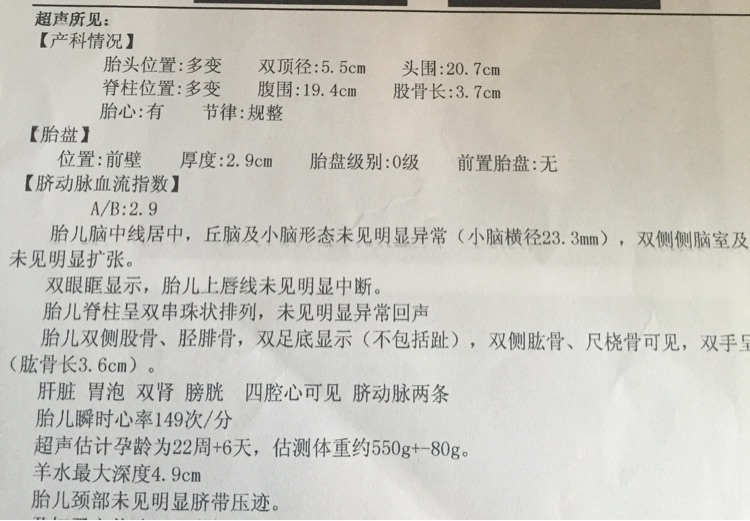 16个症状看你怀的是不是双胞胎,16种虚症自测