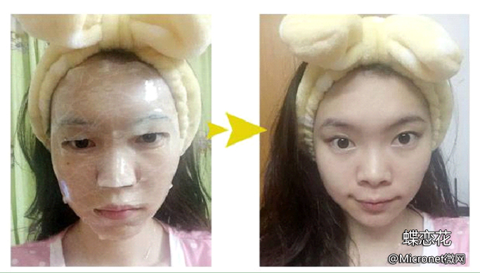 臻靓微蛋白蕾丝面膜,臻靓保湿隐形面膜