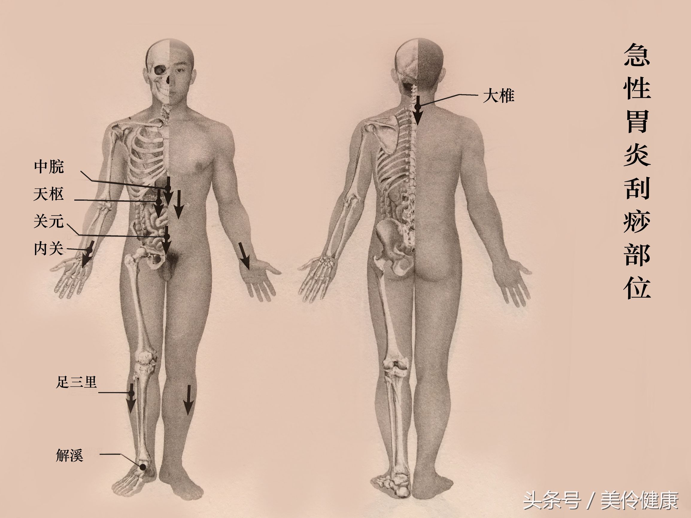 胃炎反复用药,胃炎反反复复发作吃什么中药