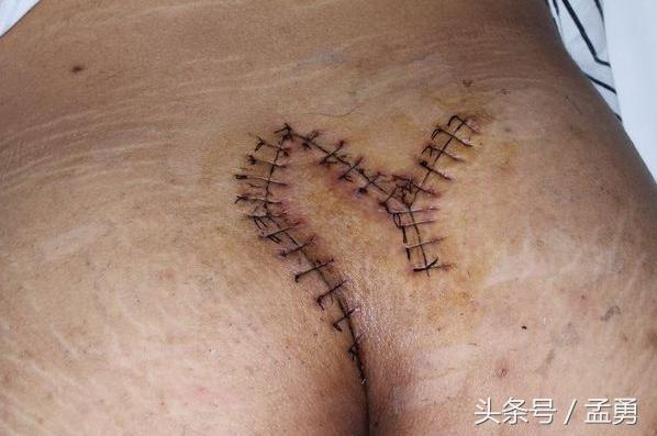 吉普车都有哪些小毛病,吉普车综合症是什么意思