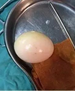 妇科医生的工作到底有多雷人？诊室里的故事让人啼笑皆非