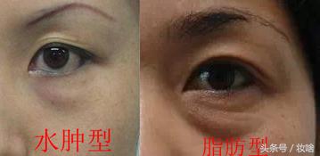 真正有效果的去黑眼圈眼霜,真正可以去黑眼圈平价眼霜