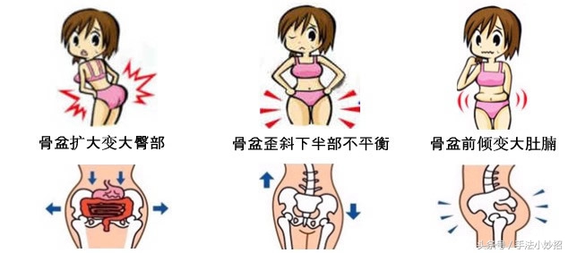 臀上皮神经损伤怎么松解比较好,臀上皮神经完全坏死的症状