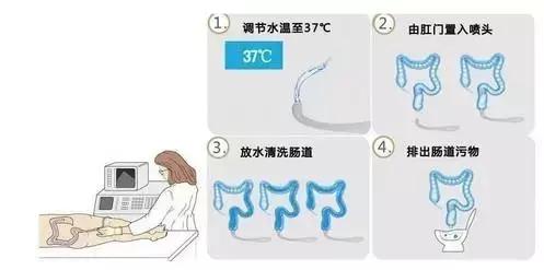 清肠是白天清肠还是晚上清肠好,经常清肠对身体的好处和坏处