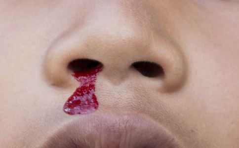 冬季流鼻血注意吃什么东西不上火,到了冬季老是流鼻血怎么回事