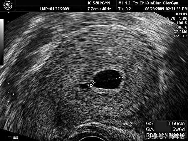 怀孕宝典软件哪个好用,怀孕宝典哪个好