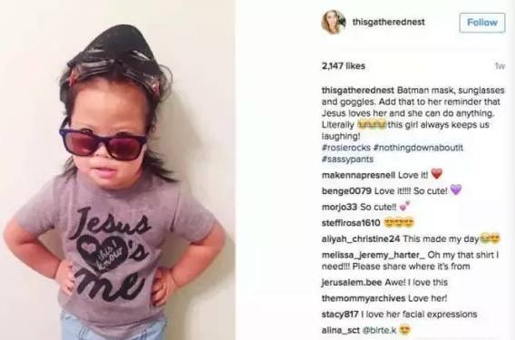 唐氏弃婴变成美国人,唐氏低风险生出唐氏儿吗