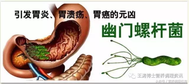 让我们一起加入“幽门螺旋杆菌”的战斗中吧!