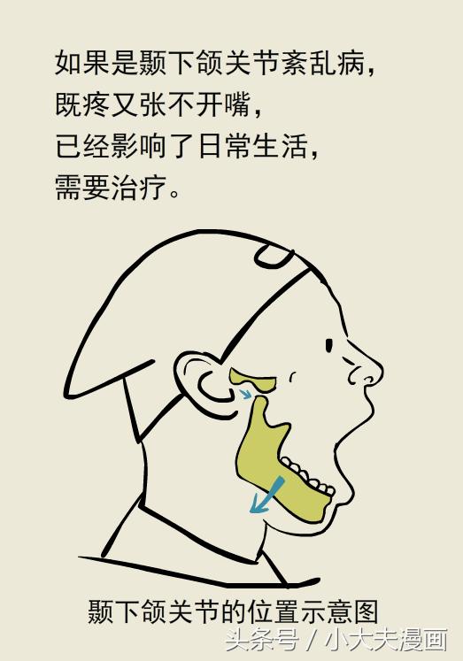 一张嘴下颌关节就疼,一张嘴腮帮子骨头还疼