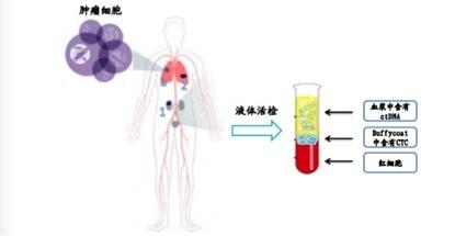 索真基因：液体活检——癌症患者的福音