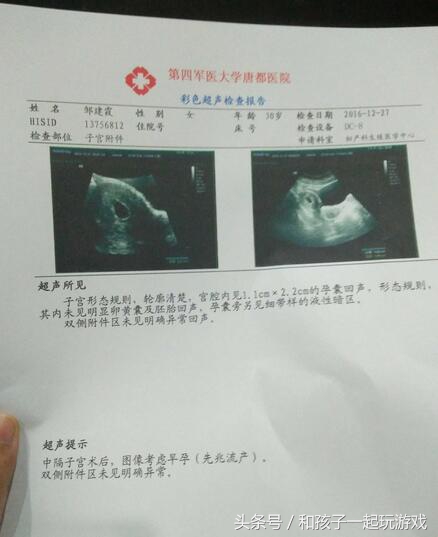 孕早期宫内出血能保住吗,怀孕早期出血辨别宫内还是宫外