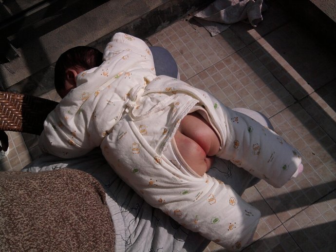 宝宝红屁股妈妈心疼哭了,宝宝屁股红疼如何快速解决问题