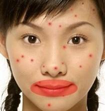 脸上长痘痘是什么原因一碰就疼,脸上长痘痘是什么原因怎么解决