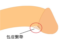 你可知道，连着冠状沟和*头龟**之间那根系带作用真不少，断了就..