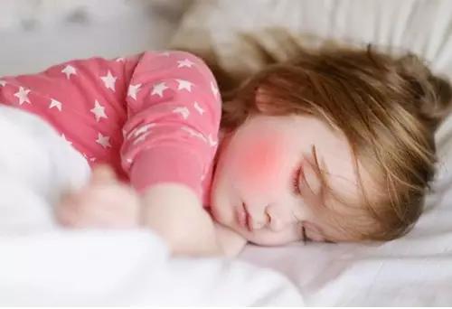 孩子四个地方变红家长一定要重视,爸妈看宝宝反应