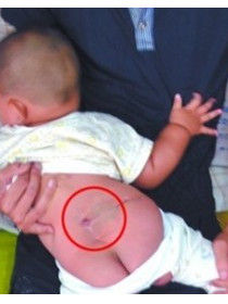 借你一双慧眼，祝你早日发现宝宝是否有脊柱裂！