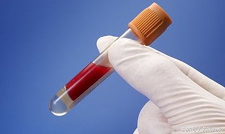 中医怎样降血脂最快最好的方法,中医如何降血脂才有效