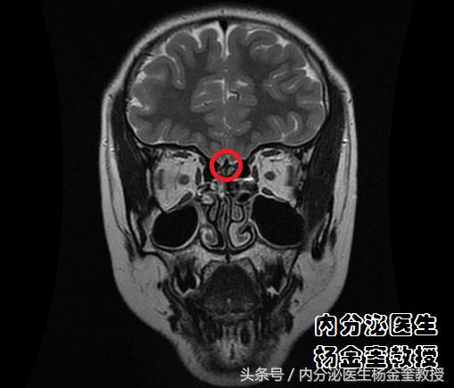 为什么青春期的男孩很臭,嗅觉失灵香臭都闻不到该怎么办
