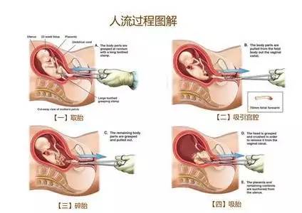 怎么生个健康宝宝科普,怎样生一个健康没有缺陷的宝宝