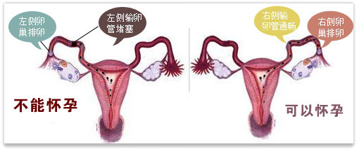 怀不上孕女性做什么检查,怀不上孩子女性查什么