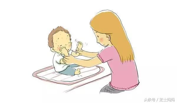 宝贝湿疹用什么药膏,宝贝湿疹怎么解决