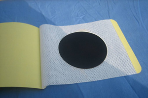 临床上有哪些治疗滑膜炎的方法