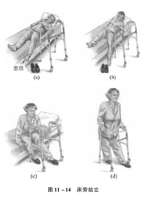 老年运动系统疾病的照护：常见部位骨折的照护要点（二）