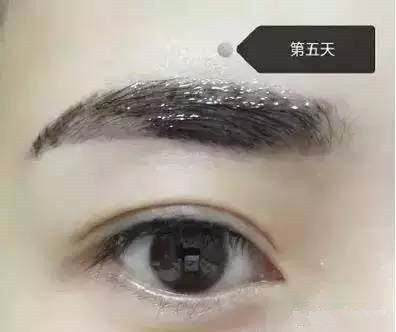 纹眉后恢复过程不要惊慌,男士纹眉恢复全过程图片